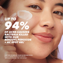 Benzac AC High Strength 10% Acne Gel 60g